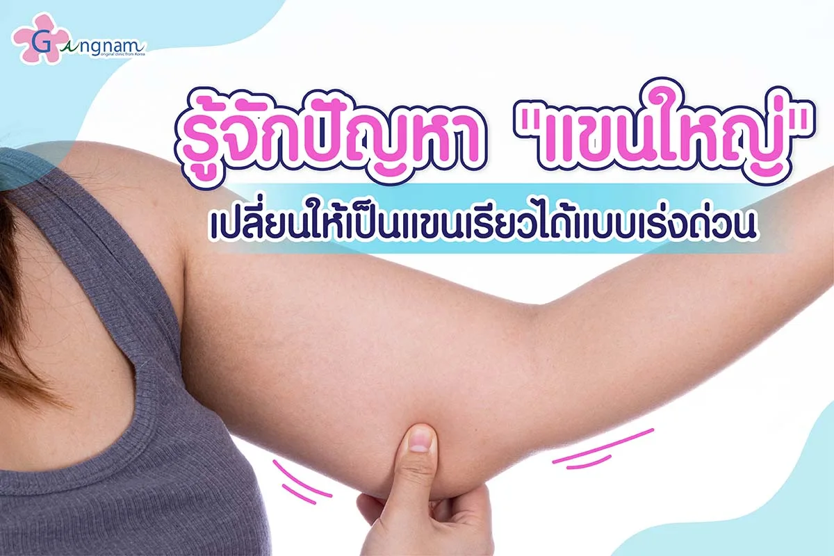 รู้จักปัญหา &#8220;แขนใหญ่&#8221; เปลี่ยนให้เป็นแขนเรียวได้แบบเร่งด่วน