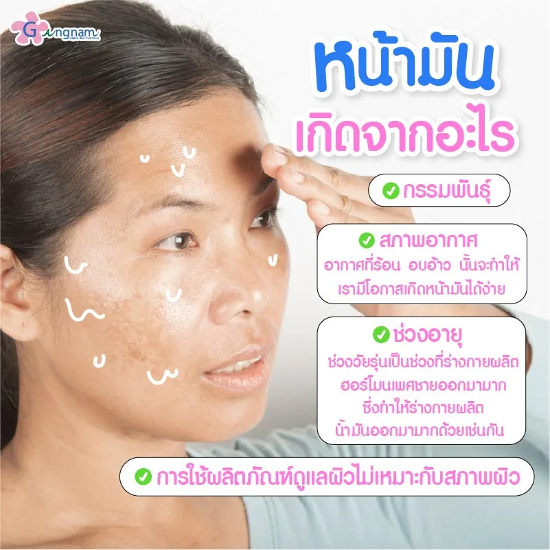 หน้ามันเกิดจากอะไร