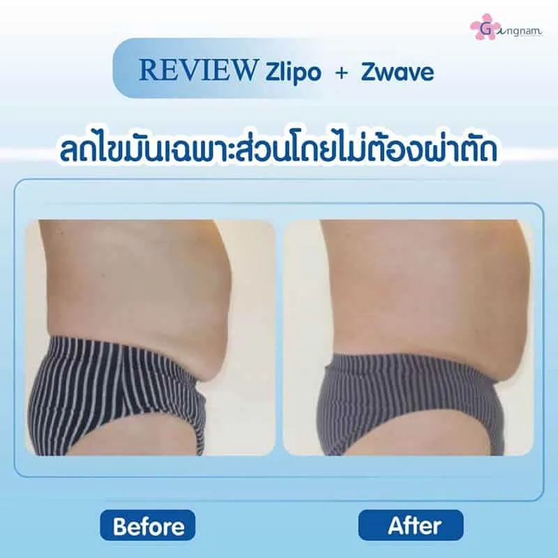 รีวิวลูกค้า 72