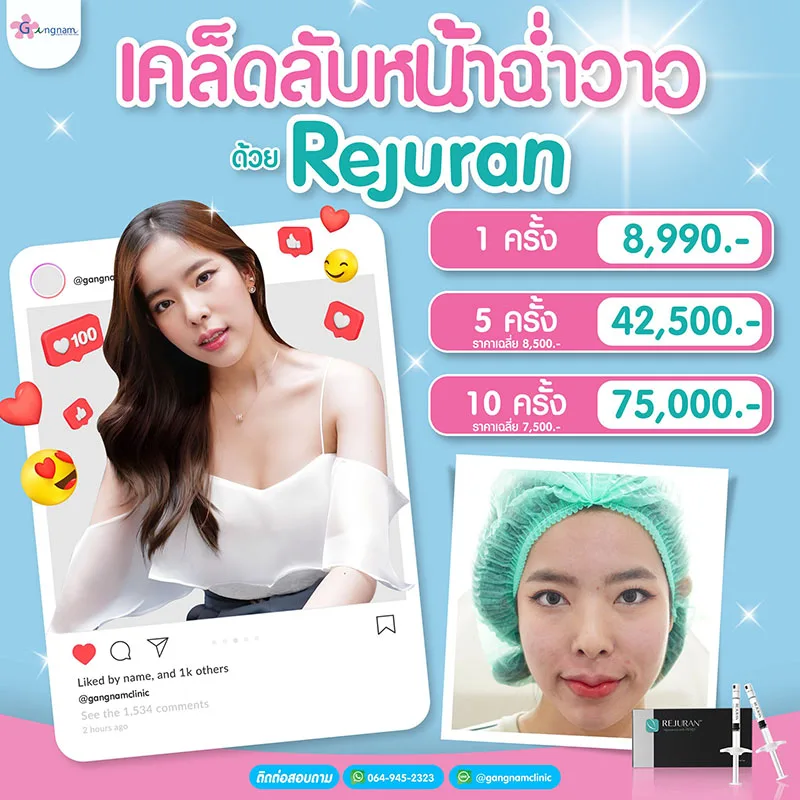 ราคาค่าฉีดรีจูรัน ต่อครั้ง