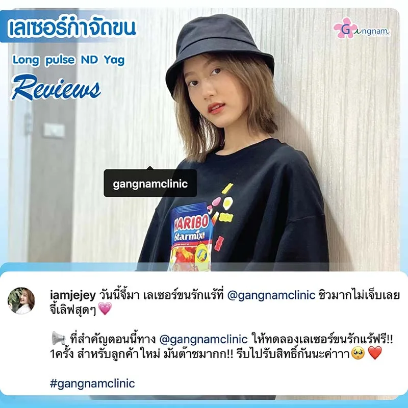 หลังเลเซอร์รักแร้ ชิวมากไม่เจ็บเลย