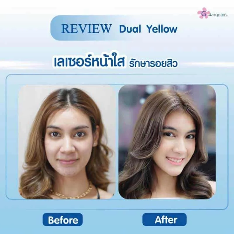 รีวิวลูกค้า 41