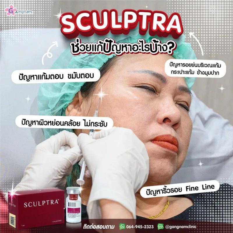 Sculptra ช่วยเรื่องอะไรบ้าง