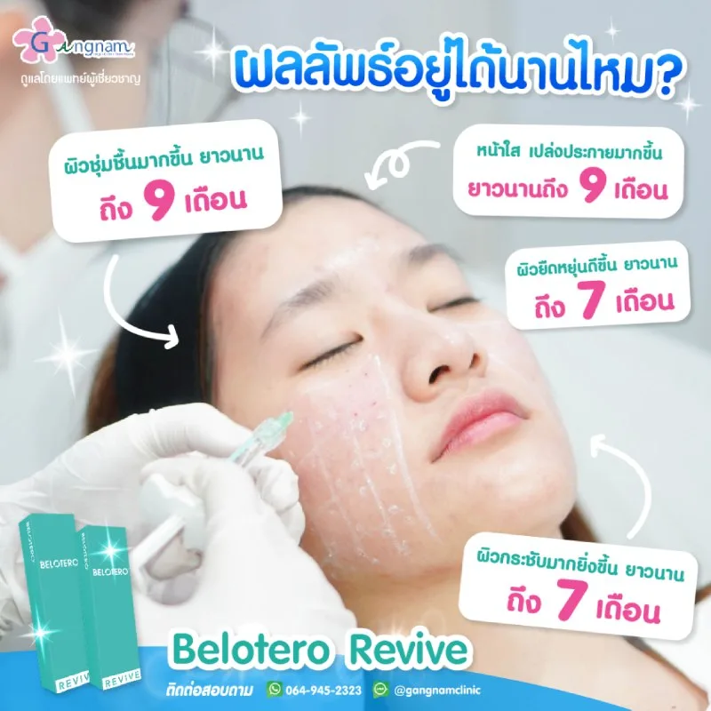 Belotero Revive เห็นผลนานไหม