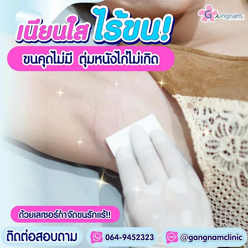 รักแร้หนังไก่ เกิดจากอะไร? มีวิธีแก้ยังไง ให้ตุ่มหนังไก่หาย ผิวกลับมาเนียนนุ่ม