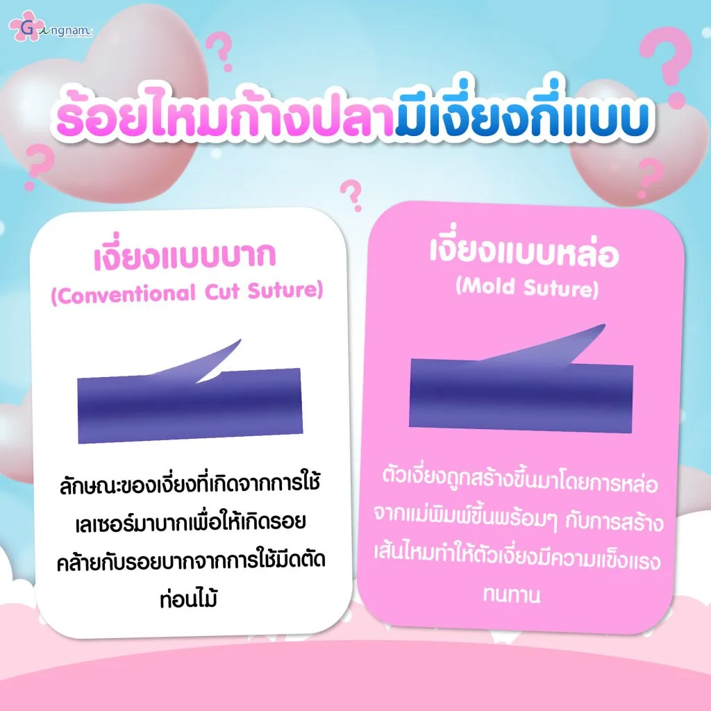 ร้อยไหมก้างปลามีเงี่ยงกี่แบบ