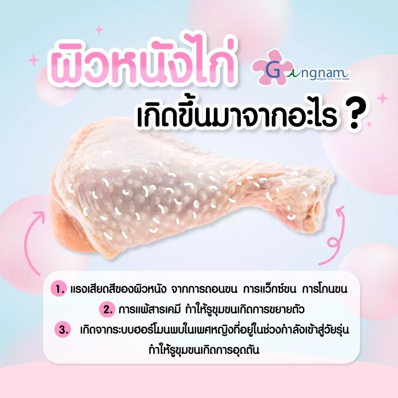 ผิวหนังไก่ เกิดจากอะไร