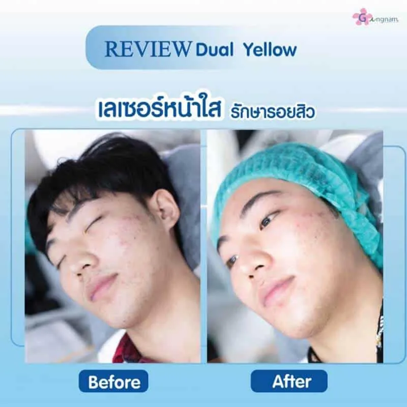 รีวิวลูกค้า 43