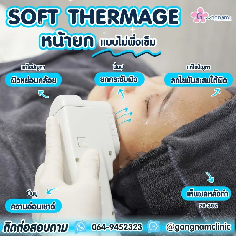 เครื่อง Thermage