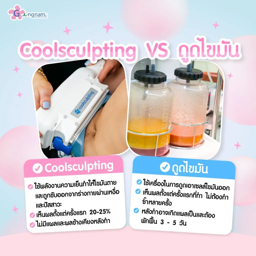 Coolsculpting VS ดูดไขมัน