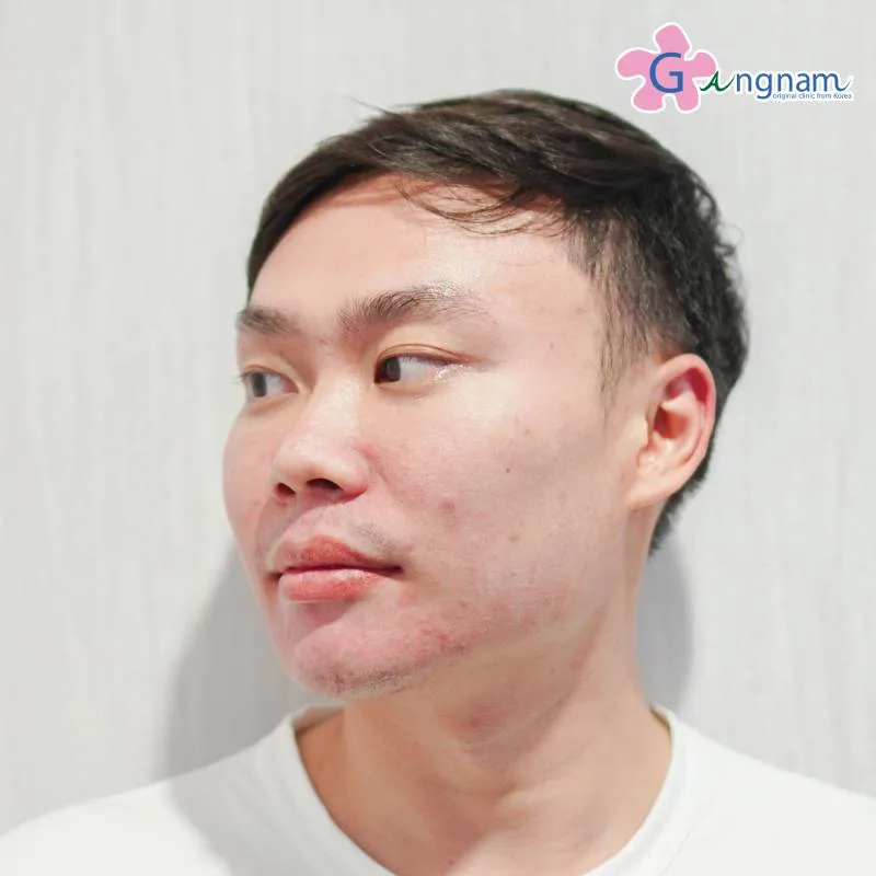 คุณไปร์ท หลังทำทันที