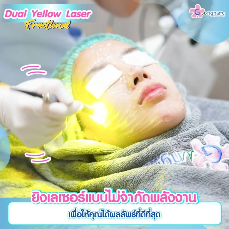 Dual Yellow รักษาผิวหน้าหมองคล้ำ