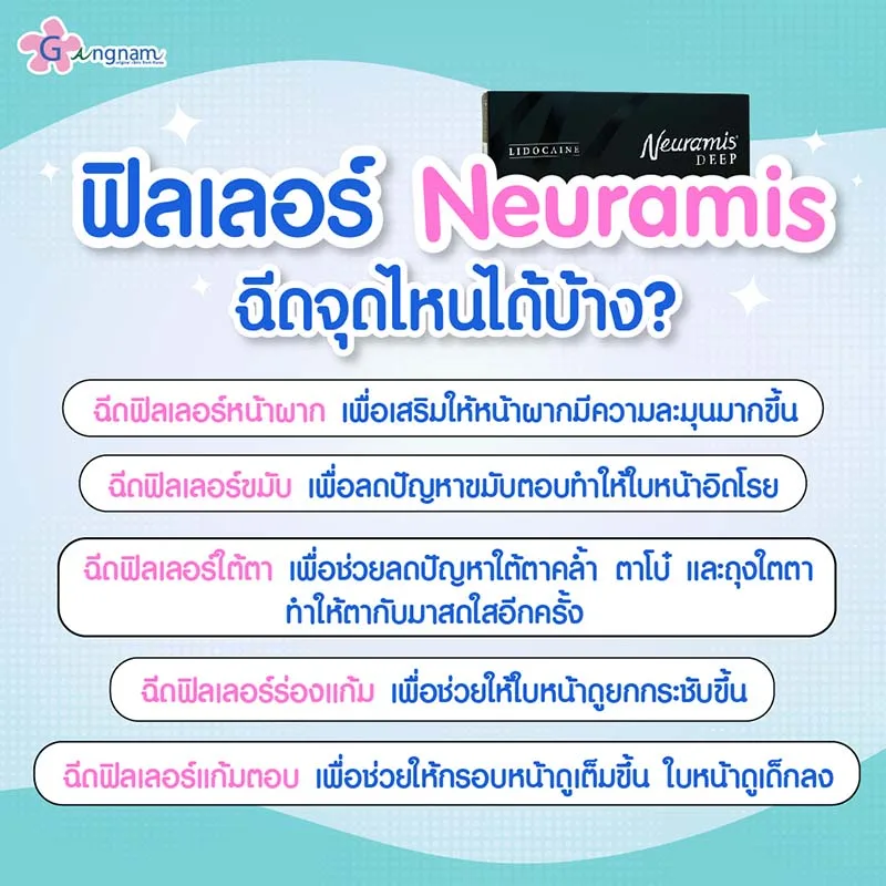 ฟิลเลอร์-Neuramis-นิยมฉีดจุดไหน