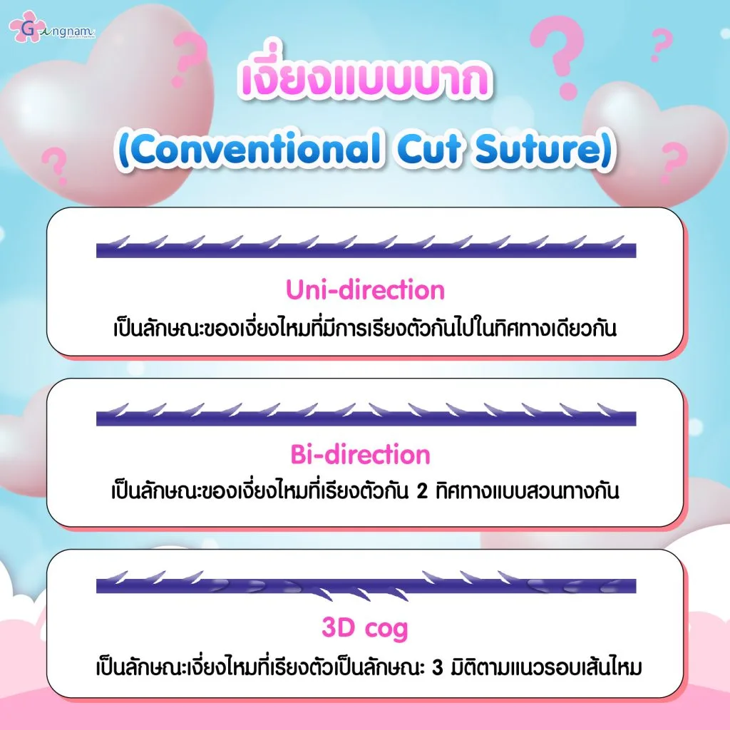 เงี่ยงแบบบาก