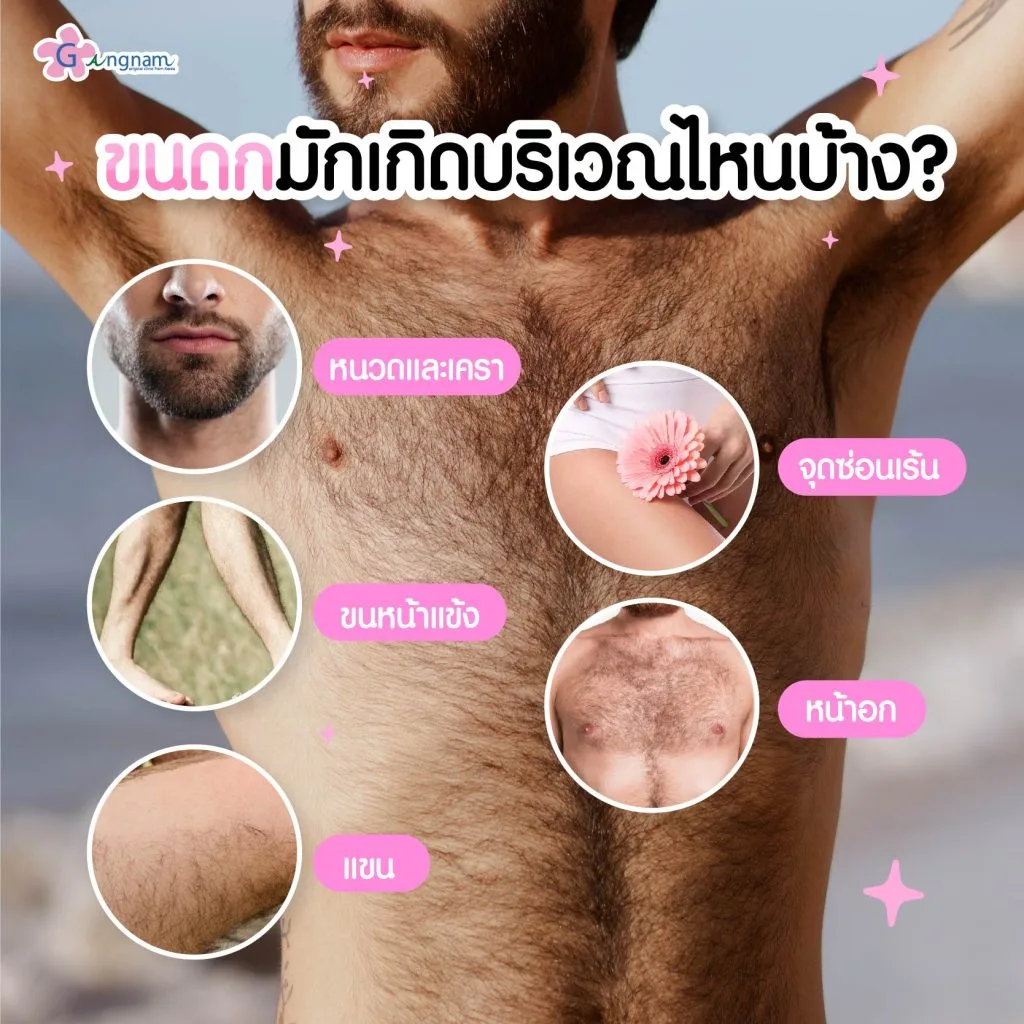 ขนดกเกิดบริเวณไหนบ้าง