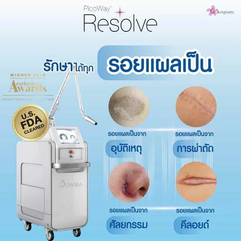 เครื่อง laser pico way รักษารอยอะไรได้บ้าง