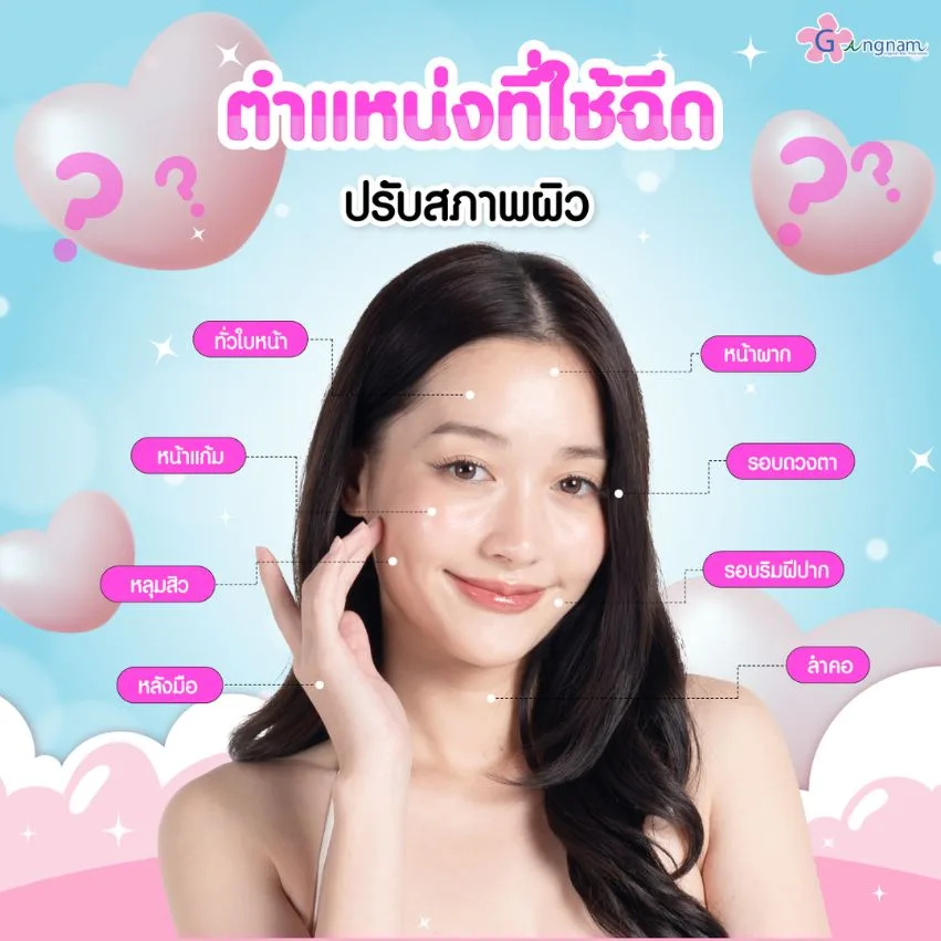 ตำแหน่งที่ใช้ฉีดปรับสภาพผิว