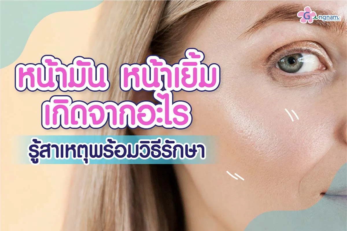 ผิวหน้ามัน หน้าเยิ้ม เกิดจากอะไร? รู้สาเหตุพร้อมวิธีรักษา
