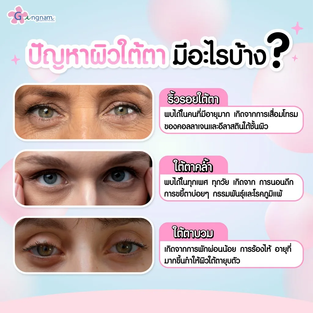 ปัญหาผิวใต้ตามีอะไรบ้าง