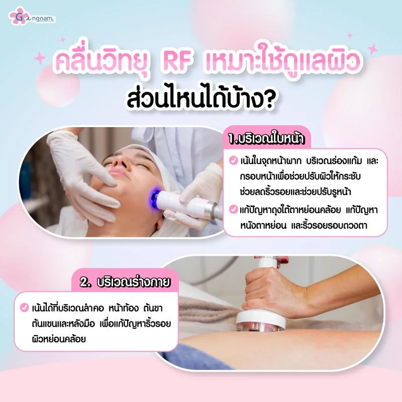 คลื่น RF เหมาะใช้ดูแลผิวส่วนไหน