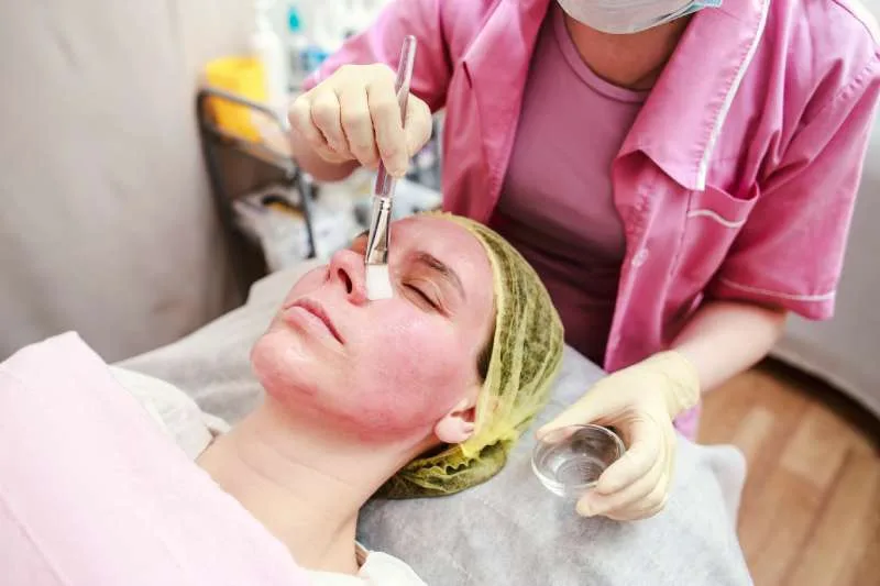 ใช้สารเคมีลอกผิว (Chemical Peel)
