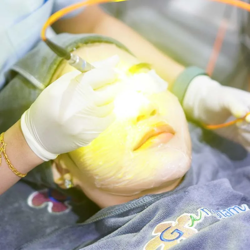 dual yellow laser ปรับสภาพผิวหน้าหมองคล้ำ