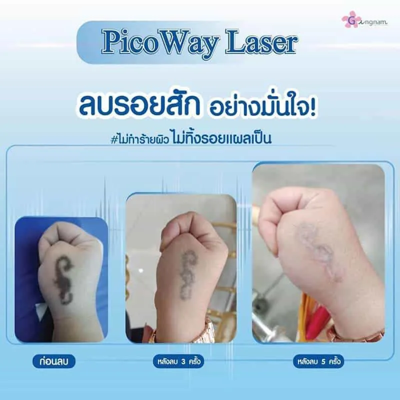 รีวิวลูกค้า 33