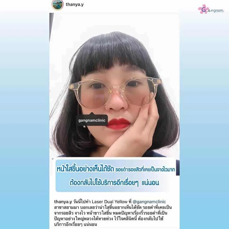รีวิวลูกค้า 54