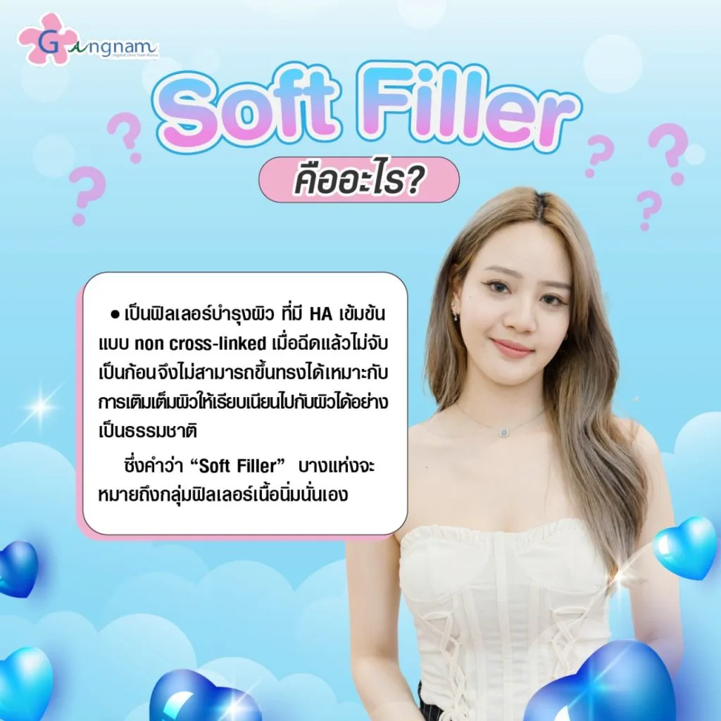 soft filler คืออะไร
