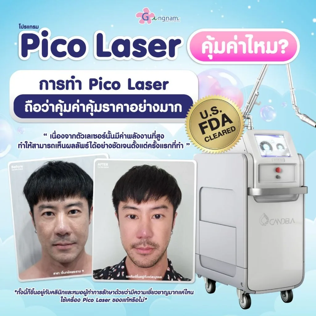 โปรแกรม pico laser คุ้มค่าหรือไม่