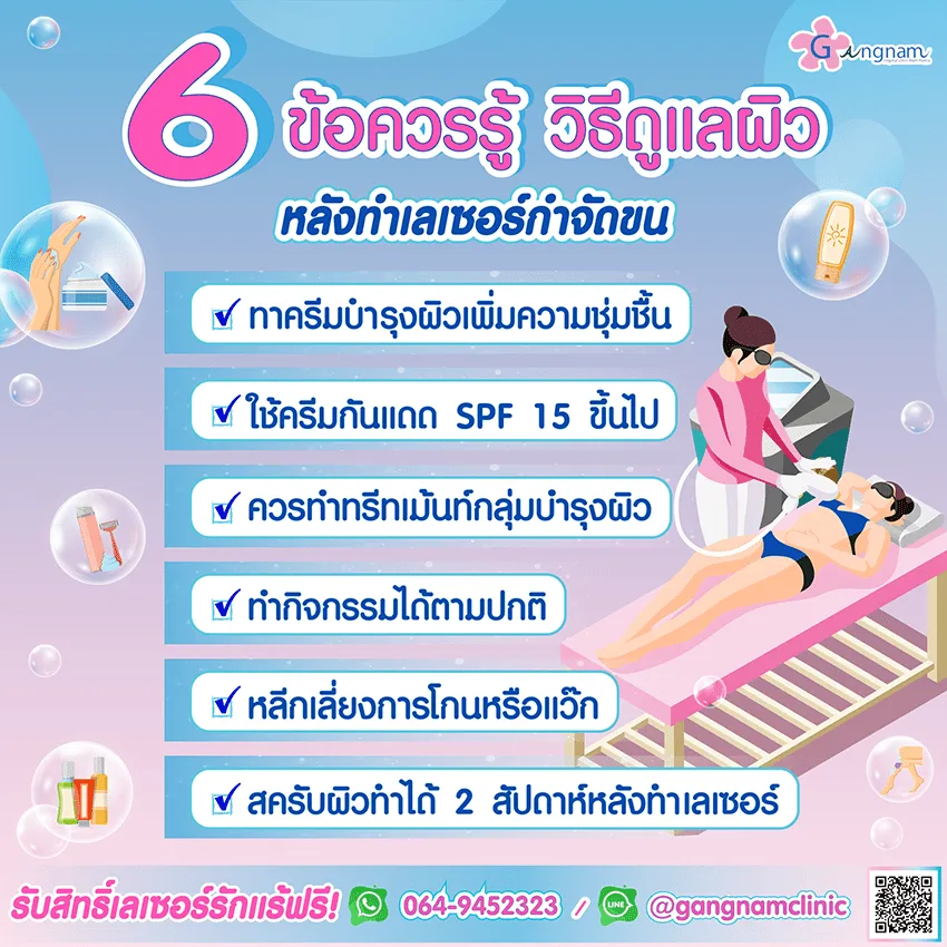 เลเซอร์ขน