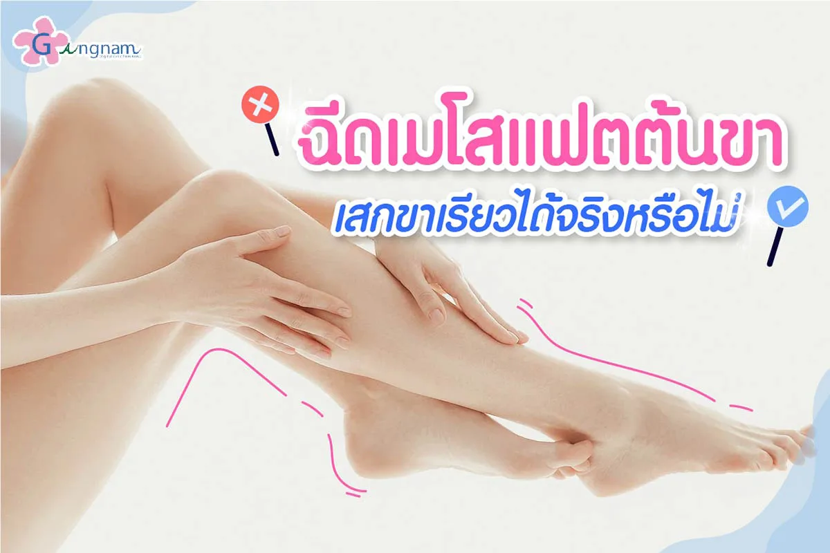 ฉีดเมโสแฟตต้นขา เสกให้ขาเรียว แบบไม่เจ็บ เหมาะกับใคร?