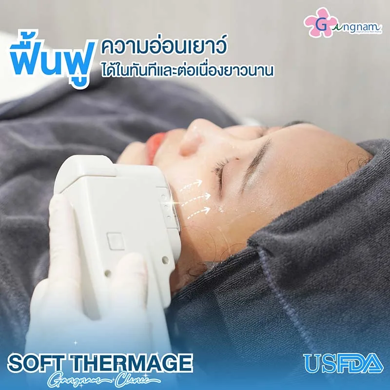 soft Thermage ยกกระชับหน้า V