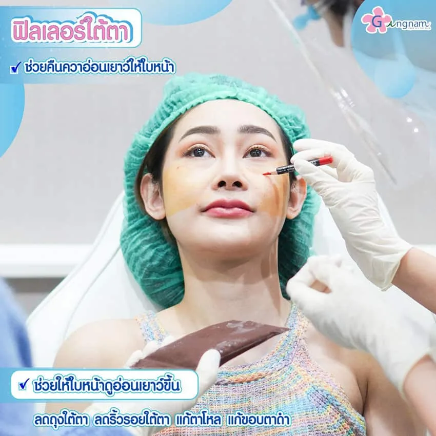 ฟิลเลอร์ช่วยแก้ปัญหาใต้ตาเรื่องอะไรบ้าง