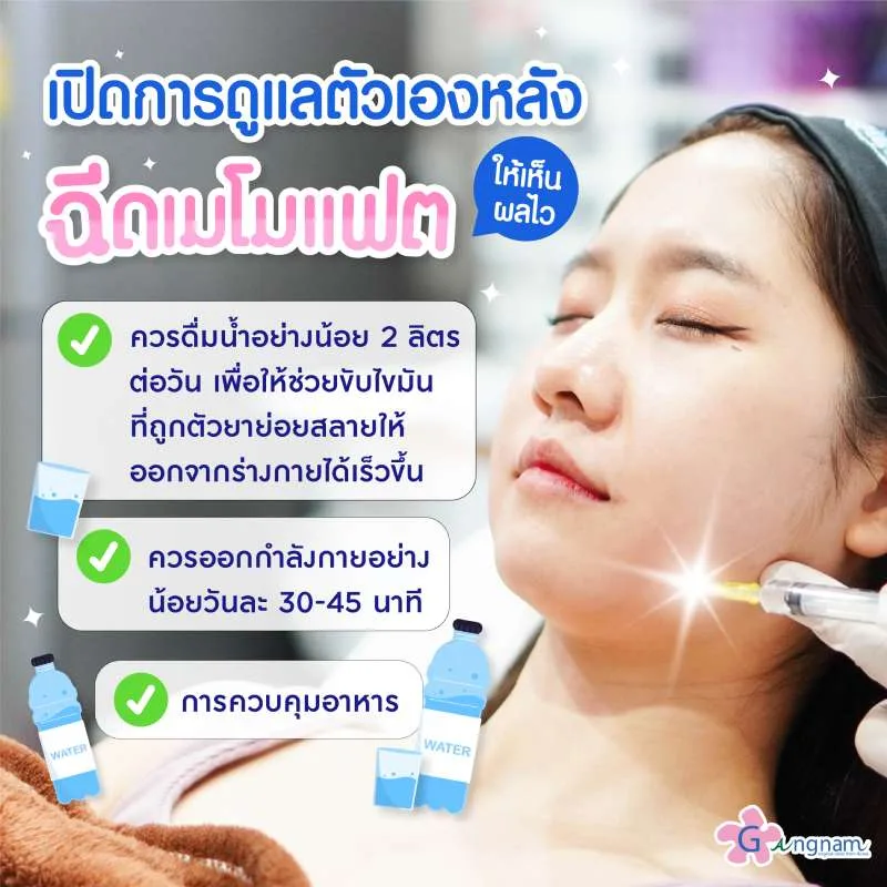 การดูแลตัวเองหลังฉีดเมโมแฟต