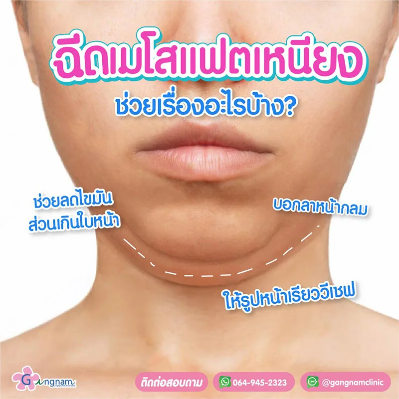 แฟตเหนียง-ช่วยอะไรบ้าง