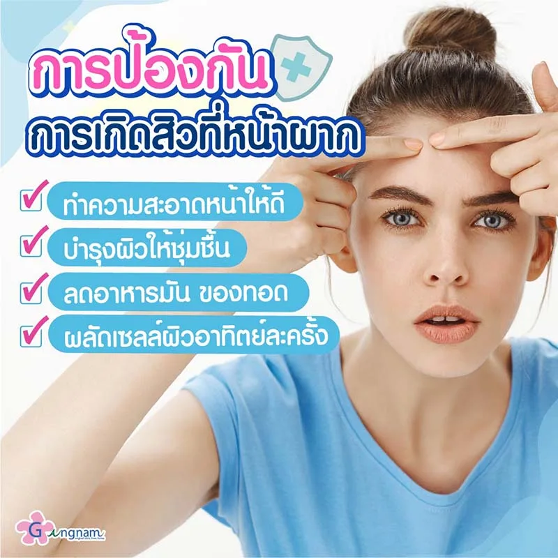 การดูแลและป้องกันการเกิดสิวที่หน้าผาก