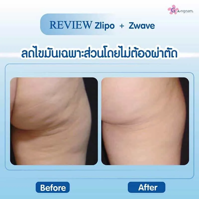 รีวิวลูกค้า 70