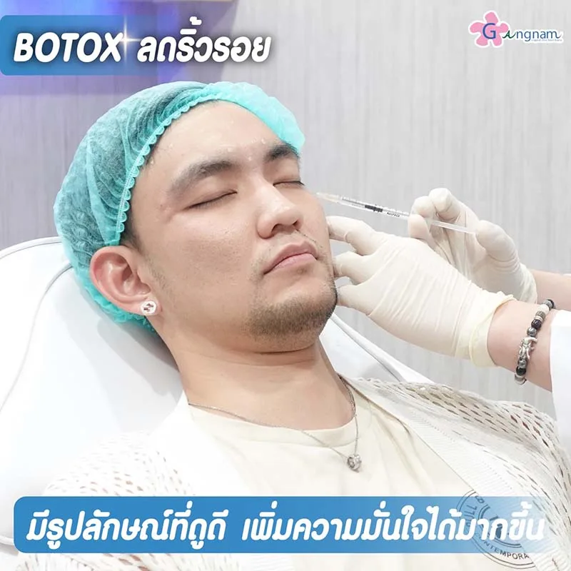 Botox ลดริ้วรอยใต้ตา