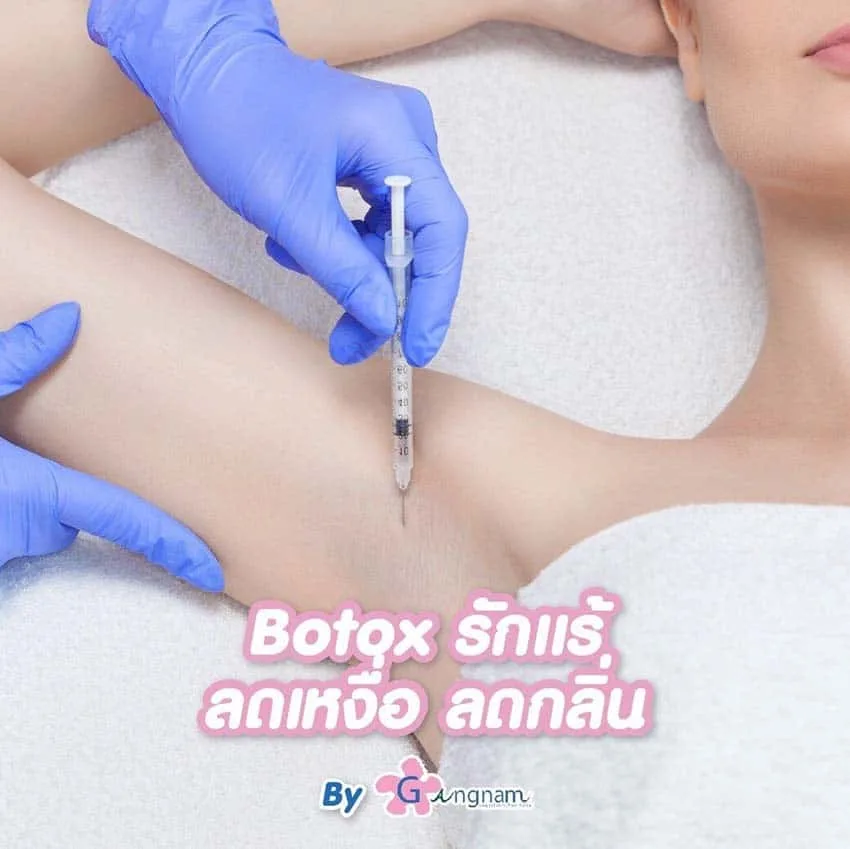 ลดเหงื่อรักแร้ ด้วย Botox