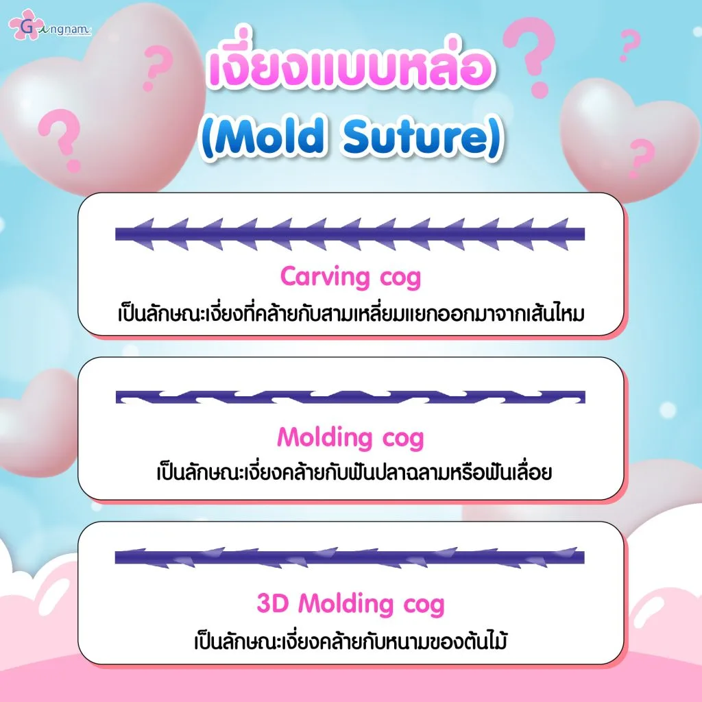 เงี่ยงแบบหล่อ