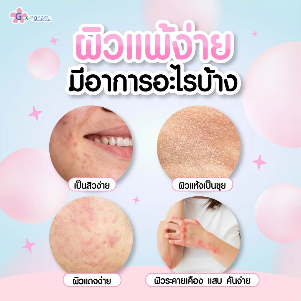 แพ้ง่าย มีอาการอะไรบ้าง