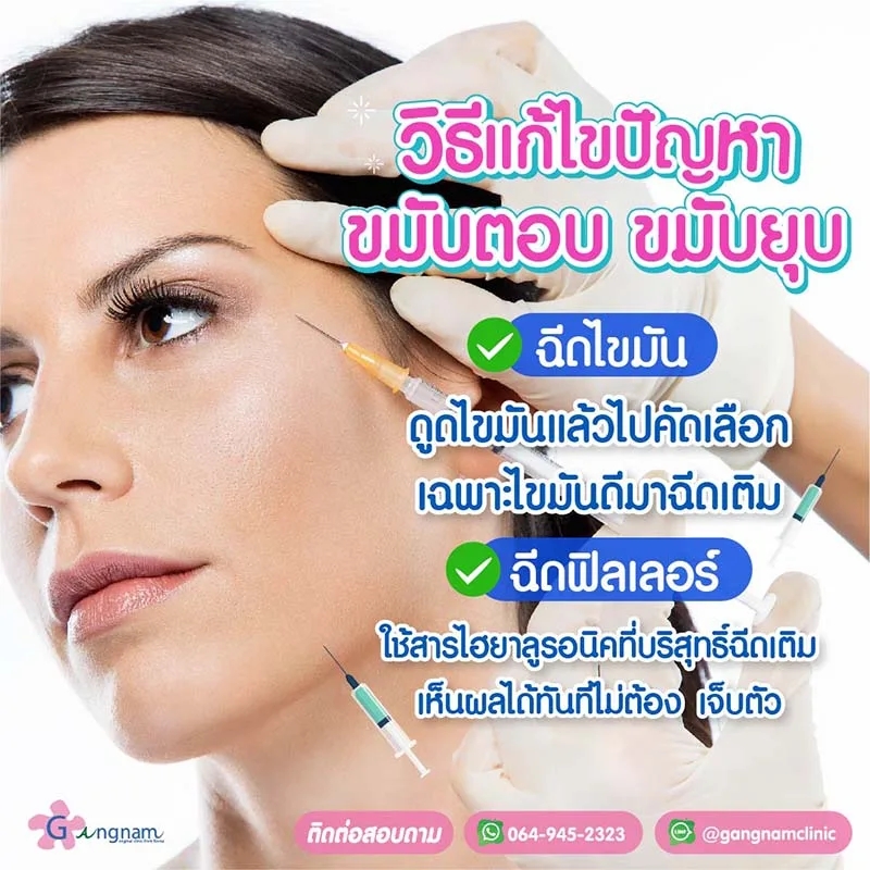 วิธีแก้ปัญหาขมุบตอบ และขมับยุบ