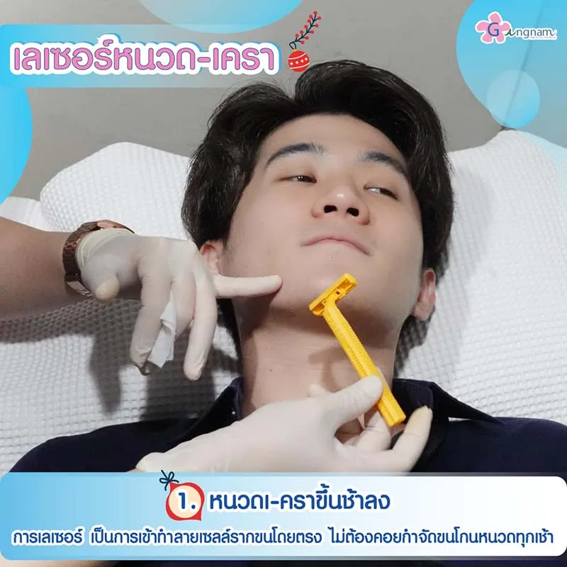ข้อดีของการเลเซอร์หนวด
