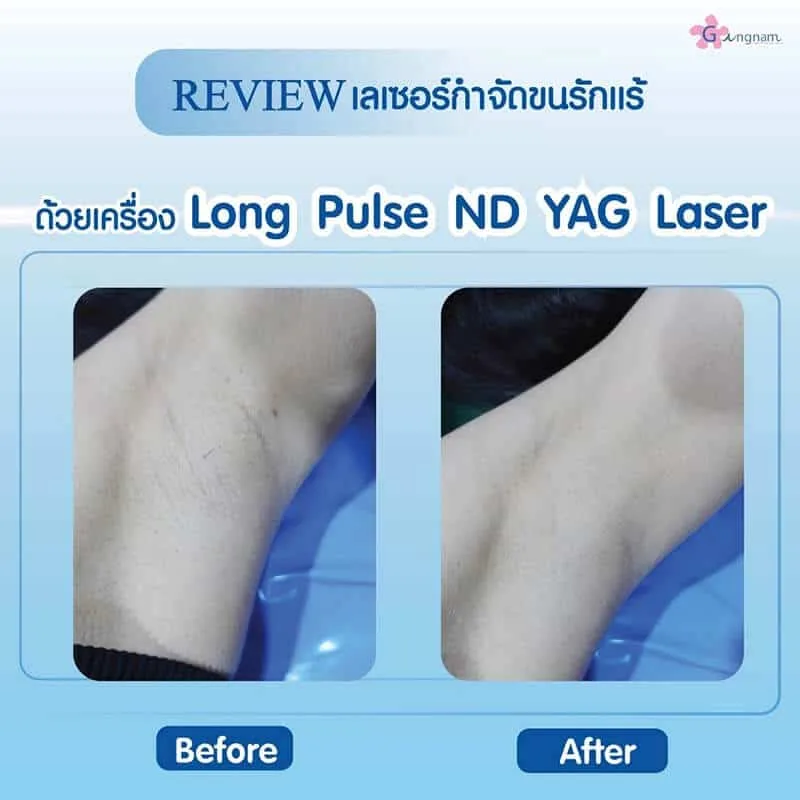 รีวิวลูกค้า 24