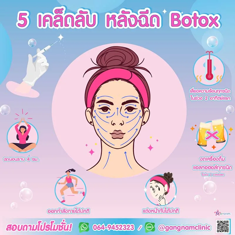 การปฎิบัติตัวหลังฉีดโบท็อก