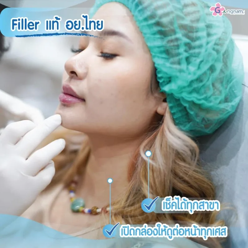 ฟิลเลอร์ Juvederm อย.