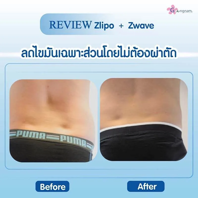 รีวิวลูกค้า 73