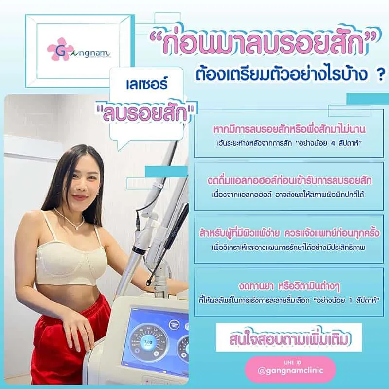 ก่อนลบรอยสักเตรียมตัวอย่างไร