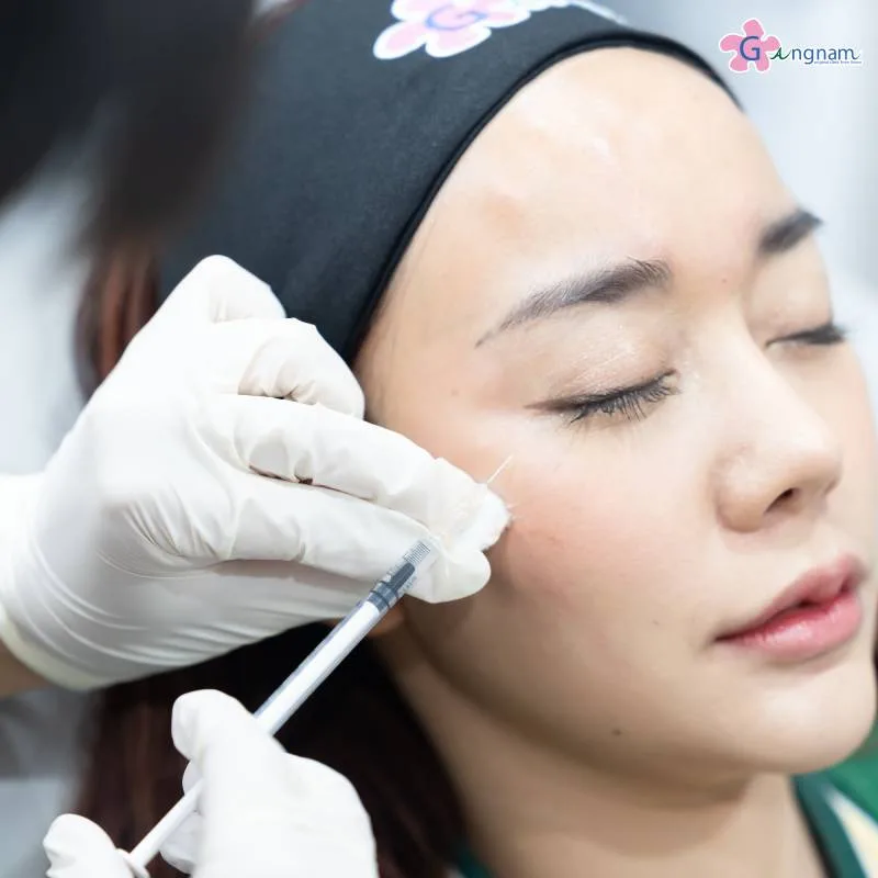 ฉีดโบท็อกซ์ (Botox)